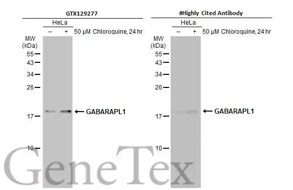 Untreated (–) and treated (+) HeLa whole cell extracts (30 μg) were separated by 15% SDS-PAGE, and the membranes were blotted with GABARAPL1 antibody (GTX129277) diluted at 1:500 and competitor's antibody diluted at 1:500. The HRP-conjugated anti-rabbit IgG antibody (GTX213110-01) was used to detect the primary antibody. *The competitor is not affiliated with GeneTex and does not endorse this product.