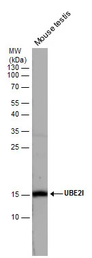 Mouse tissue extract (50 μg) was separated by 15% SDS-PAGE, and the membrane was blotted with UBE2I antibody (GTX129293) diluted at 1:1000.