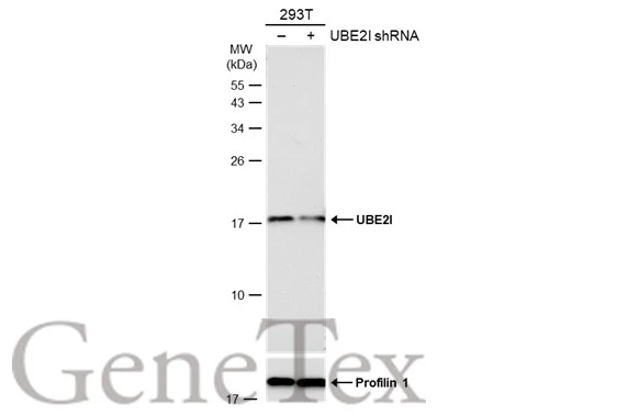 Non-transfected (–) and transfected (+) 293T whole cell extracts (30 μg) were separated by 15% SDS-PAGE, and the membrane was blotted with UBE2I antibody (GTX129293) diluted at 1:2000. The HRP-conjugated anti-rabbit IgG antibody (GTX213110-01) was used to detect the primary antibody.