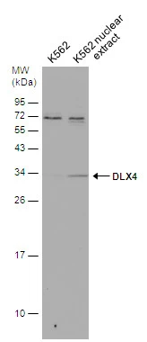 K562 whole cell and nuclear extracts (30 μg) were separated by 12% SDS-PAGE, and the membrane was blotted with DLX4 antibody (GTX129318) diluted at 1:500.