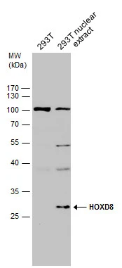 293T whole cell and nuclear extracts (30 μg) were separated by 12% SDS-PAGE, and the membrane was blotted with HOXD8 antibody (GTX129324) diluted at 1:500.