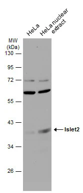 HeLa whole cell and nuclear extracts (30 μg) were separated by 10% SDS-PAGE, and the membrane was blotted with Islet2 antibody (GTX129375) diluted at 1:500. The HRP-conjugated anti-rabbit IgG antibody (GTX213110-01) was used to detect the primary antibody.