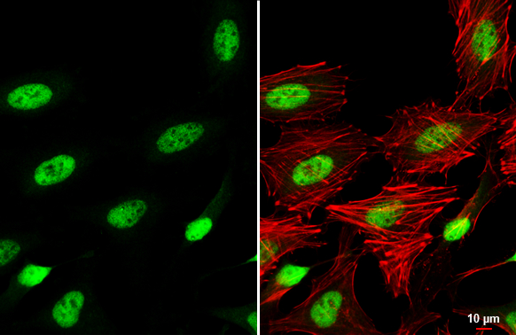 SP3 antibody detects SP3 protein at nucleus by immunofluorescent analysis. Sample: HeLa cells were fixed in 4% paraformaldehyde at RT for 15 min. Green: SP3 stained by SP3 antibody (GTX129426) diluted at 1:500. Red: phalloidin, a cytoskeleton marker, diluted at 1:200. Scale bar= 10 μm.