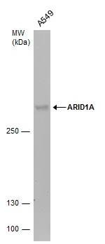 ARID1A antibody detects ARID1A protein by western blot analysis. Whole cell extracts (30 μg) was separated by 5% SDS-PAGE, and the membrane was blotted with ARID1A antibody (GTX129433) diluted by 1:1000.