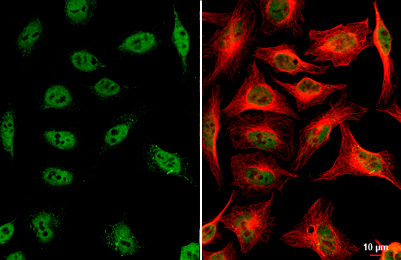 ARID1A antibody detects ARID1A protein at nucleus by immunofluorescent analysis. Sample: HeLa cells were fixed in 4% paraformaldehyde at RT for 15 min. Green: ARID1A stained by ARID1A antibody (GTX129433) diluted at 1:500. Red: alpha Tubulin, a cytoskeleton marker, stained by alpha Tubulin antibody [GT114] (GTX628802) diluted at 1:1000. Scale bar= 10μm.