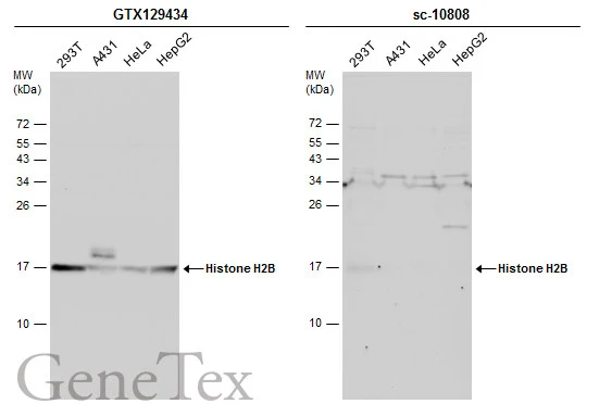 Various whole cell extracts (30 μg) were separated by 15% SDS-PAGE, and the membranes were blotted with Histone H2B antibody (GTX129434) diluted at 1:500 and competitor's antibody (sc-10808) diluted at 1:500. The HRP-conjugated anti-rabbit IgG antibody (GTX213110-01) was used to detect the primary antibody. *The competitor is not affiliated with GeneTex and does not endorse this product.