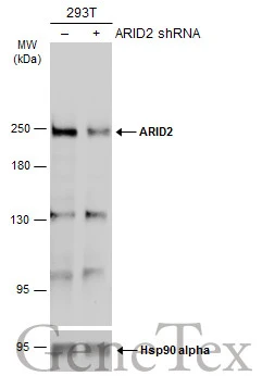 Non-transfected (–) and transfected (+) 293T whole cell extracts (50 μg) were separated by 5% SDS-PAGE, and the membrane was blotted with ARID2 antibody (GTX129443) diluted at 1:1000. The HRP-conjugated anti-rabbit IgG antibody (GTX213110-01) was used to detect the primary antibody, and the signal was developed with Trident ECL plus-Enhanced.
