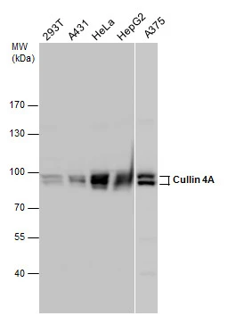Various whole cell extracts (30 μg) were separated by 7.5% SDS-PAGE, and the membrane was blotted with Cullin 4A antibody (GTX129459) diluted at1:1000.