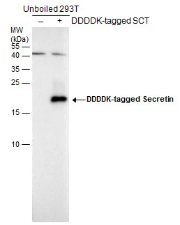 Non-transfected (–) and transfected (+) unboiled 293T whole cell extracts (30 μg) were separated by 15% SDS-PAGE, and the membrane was blotted with Secretin antibody (GTX129460) diluted at 1:5000. The HRP-conjugated anti-rabbit IgG antibody (GTX213110-01) was used to detect the primary antibody.