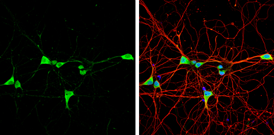 VIP antibody