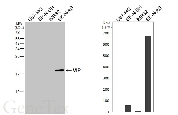 Various whole cell extracts (30 μg) was separated by 15% SDS-PAGE, and the membrane was blotted with VIP antibody (GTX129461) diluted at 1:4500. The HRP-conjugated anti-rabbit IgG antibody (GTX213110-01) was used to detect the primary antibody. Corresponding RNA expression data for the same cell lines are based on Human Protein Atlas program.