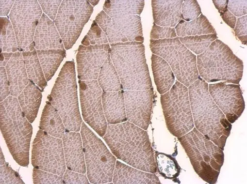 TLX3 antibody detects TLX3 protein at nucleus on mouse fore brain by immunohistochemical analysis. Sample: Paraffin-embedded mouse fore brain. TLX3 antibody (GTX129465) dilution: 1:500. 
 Antigen Retrieval: Trilogy? (EDTA based, pH 8.0) buffer, 15min