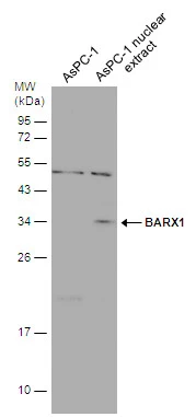 AsPC-1 whole cell and nuclear extracts (30 μg) were separated by 12% SDS-PAGE, and the membrane was blotted with BARX1 antibody (GTX129470) diluted at 1:1000. AsPC-1 whole cell and nuclear extracts (30 μg) were separated by 12% SDS-PAGE, and the membrane was blotted with BARX1 antibody (GTX129470) diluted at 1:1000.