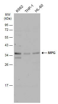 Various whole cell extracts (30 μg) were separated by 12% SDS-PAGE, and the membrane was blotted with MPG antibody (GTX129483) diluted at 1:500. The HRP-conjugated anti-rabbit IgG antibody (GTX213110-01) was used to detect the primary antibody.