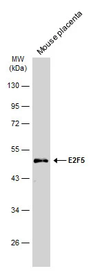 Mouse tissue extract (50 μg) was separated by 10% SDS-PAGE, and the membrane was blotted with E2F5 antibody (GTX129491) diluted at 1:500. The HRP-conjugated anti-rabbit IgG antibody (GTX213110-01) was used to detect the primary antibody.