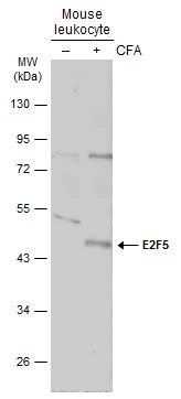 Untreated (–) and treated (+) Mouse leukocyte extracts (30 μg) were separated by 10% SDS-PAGE, and the membrane was blotted with E2F5 antibody (GTX129491) diluted at 1:500. The HRP-conjugated anti-rabbit IgG antibody (GTX213110-01) was used to detect the primary antibody.