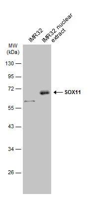 IMR32 whole cell and nuclear extracts (30 μg) were separated by 10% SDS-PAGE, and the membrane was blotted with SOX11 antibody (GTX129501) diluted at 1:1000. The HRP-conjugated anti-rabbit IgG antibody (GTX213110-01) was used to detect the primary antibody, and the signal was developed with Trident ECL plus-Enhanced.