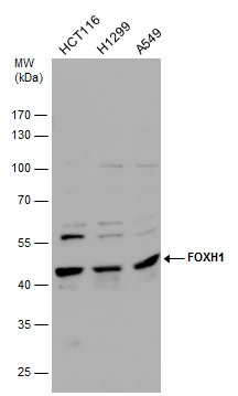 Various whole cell extracts (30 μg) were separated by 10% SDS-PAGE, and the membrane was blotted with FOXH1 antibody (GTX129508) diluted at 1:1000.