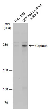 U87-MG whole cell and nuclear extracts (30 μg) were separated by 5% SDS-PAGE, and the membrane was blotted with Capicua antibody (GTX129513) diluted at 1:500. The HRP-conjugated anti-rabbit IgG antibody (GTX213110-01) was used to detect the primary antibody, and the signal was developed with Trident ECL plus-Enhanced.