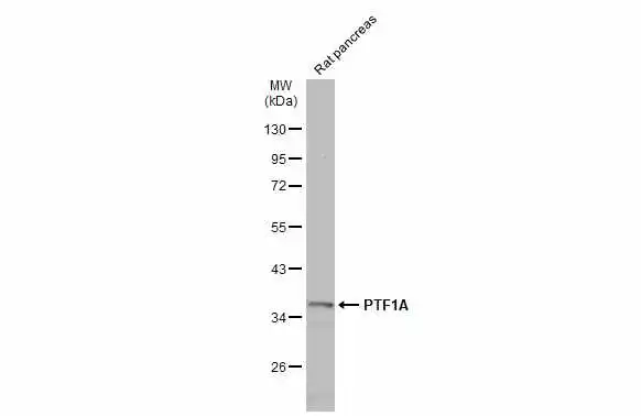 Rat tissue extract (50 μg) was separated by 10% SDS-PAGE, and the membrane was blotted with PTF1A antibody (GTX129525) diluted at 1:1000. The HRP-conjugated anti-rabbit IgG antibody (GTX213110-01) was used to detect the primary antibody.