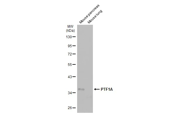 Various tissue extracts (50 μg) were separated by 10% SDS-PAGE, and the membrane was blotted with PTF1A antibody (GTX129525) diluted at 1:1000. The HRP-conjugated anti-rabbit IgG antibody (GTX213110-01) was used to detect the primary antibody.