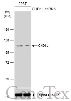 Non-transfected (–) and transfected (+) 293T whole cell extracts (30 μg) were separated by 7.5% SDS-PAGE, and the membrane was blotted with CHD1L antibody (GTX129527) diluted at 1:10000. The HRP-conjugated anti-rabbit IgG antibody (GTX213110-01) was used to detect the primary antibody.