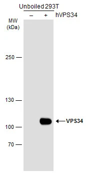 Non-transfected (–) and transfected (+) unboiled 293T whole cell extracts (30 μg) were separated by 5% SDS-PAGE, and the membrane was blotted with VPS34 antibody (GTX129528) diluted at 1:5000. The HRP-conjugated anti-rabbit IgG antibody (GTX213110-01) was used to detect the primary antibody.