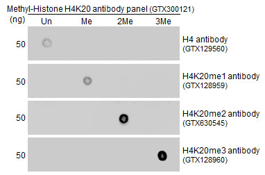 Various tissue extracts (30 ug) were separated by 15% SDS-PAGE,and the membrane was blotted with Histone H4 antibody (GTX129560) diluted at 1:1000.