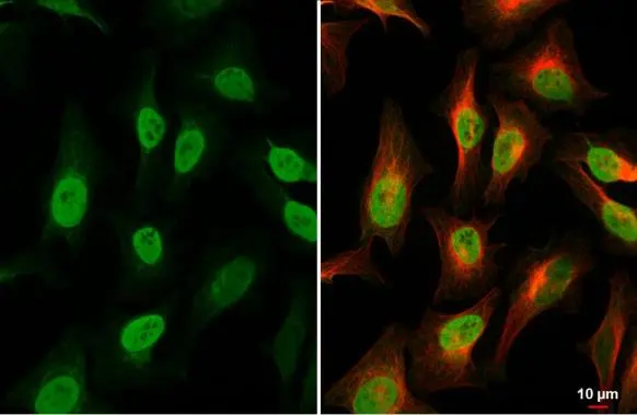 Histone H4 antibody detects Histone H4 protein at cytoplasm and nucleus by immunofluorescent analysis. Sample: HeLa cells were fixed in 4% paraformaldehyde at RT for 15 min. Green: Histone H4 stained by Histone H4 antibody (GTX129561) diluted at 1:2000. Red: alpha Tubulin, a cytoskeleton marker, stained by alpha Tubulin antibody [GT114] (GTX628802) diluted at 1:1000.