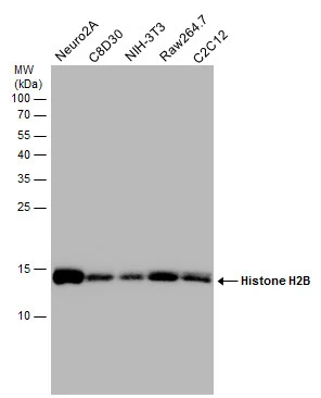 Various whole cell extracts (30 μg) were separated by 15% SDS-PAGE, and the membrane was blotted with Histone H2B antibody (GTX129565) diluted at 1:20000.