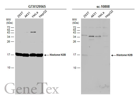 Various whole cell extracts (30 μg) were separated by 15% SDS-PAGE, and the membranes were blotted with Histone H2B antibody (GTX129565) diluted at 1:5000 and competitor's antibody (sc-10808) diluted at 1:100. The HRP-conjugated anti-rabbit IgG antibody (GTX213110-01) was used to detect the primary antibody. *The competitor is not affiliated with GeneTex and does not endorse this product.