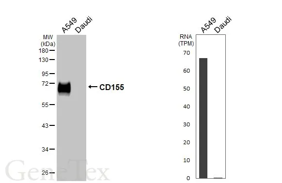 Various whole cell extracts (30 μg) were separated by 10% SDS-PAGE, and the membrane was blotted with CD155 antibody (GTX129578) diluted at 1:1000. The HRP-conjugated anti-rabbit IgG antibody (GTX213110-01) was used to detect the primary antibody. Corresponding RNA expression data are based on Human Protein Atlas program.