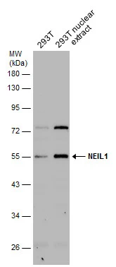293T whole cell and nuclear extracts (30 μg) were separated by 10% SDS-PAGE, and the membrane was blotted with NEIL1 antibody (GTX129607) diluted at 1:500.