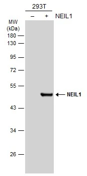 Non-transfected (–) and transfected (+) 293T whole cell extracts (30 μg) were separated by 10% SDS-PAGE, and the membrane was blotted with NEIL1 antibody (GTX129607) diluted at 1:1000. The HRP-conjugated anti-rabbit IgG antibody (GTX213110-01) was used to detect the primary antibody.