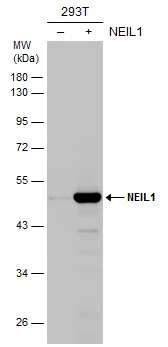 Non-transfected (–) and transfected (+) 293T whole cell extracts (30 μg) were separated by 10% SDS-PAGE, and the membrane was blotted with NEIL1 antibody (GTX129608) diluted at 1:5000.