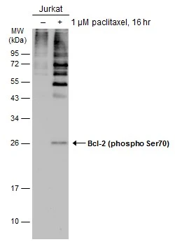 Untreated (–) and treated (+) Jurkat whole cell extracts (30 μg) were separated by 12% SDS-PAGE, and the membrane was blotted with Bcl-2 (phospho Ser70) antibody (GTX129653) diluted at 1:1000. The HRP-conjugated anti-rabbit IgG antibody (GTX213110-01) was used to detect the primary antibody.