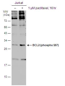 Untreated (–) and treated (+) Jurkat whole cell extracts (30 μg) were separated by 12% SDS-PAGE, and the membrane was blotted with BCL2 (phospho S87) antibody (GTX129654) diluted at 1:500. The signal was developed with Trident ECL plus-Enhanced.