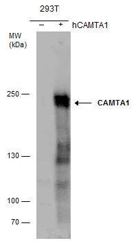CAMTA1 antibody detects CAMTA1 protein by western blot analysis. Non-transfected (-) and CAMTA1-transfected (+, ) 293T whole cell extracts (30 μg) were separated by 5% SDS-PAGE, and the membrane was blotted with CAMTA1 antibody (GTX129686) at a dilution of 1:1000.