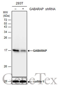 Non-transfected (–) and transfected (+) 293T whole cell extracts (30 μg) were separated by 15% SDS-PAGE, and the membrane was blotted with GABARAP antibody (GTX129710) diluted at 1:1000.