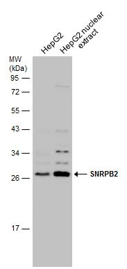 HepG2 whole cell and nuclear extracts (30 μg) were separated by 12% SDS-PAGE, and the membrane was blotted with SNRPB2 antibody (GTX129802) diluted at 1:3000.