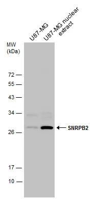 U87-MG whole cell and nuclear extracts (30 μg) were separated by 12% SDS-PAGE, and the membrane was blotted with SNRPB2 antibody (GTX129802) diluted at 1:3000.