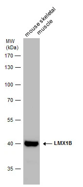 LMX1B antibody