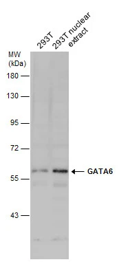 293T whole cell and nuclear extracts (30 μg) were separated by 7.5% SDS-PAGE, and the membrane was blotted with GATA6 antibody (GTX129832) diluted at 1:1000.