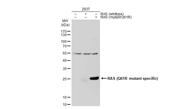 Non-transfected (–) and transfected (+) 293T whole cell extracts (30 μg) were separated by 12% SDS-PAGE, and the membrane was blotted with RAS (Q61R Mutant specific) antibody (GTX129834) diluted at 1:1000. The HRP-conjugated anti-rabbit IgG antibody (GTX213110-01) was used to detect the primary antibody.