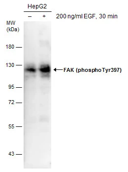 FAK (phospho Tyr397) antibody
