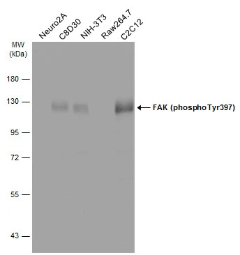 FAK (phospho Tyr397) antibody