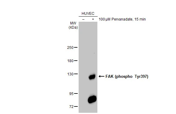 FAK (phospho Tyr397) antibody