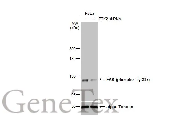 Anti-FAK (phospho Tyr397) antibody (GTX129840) | GeneTex