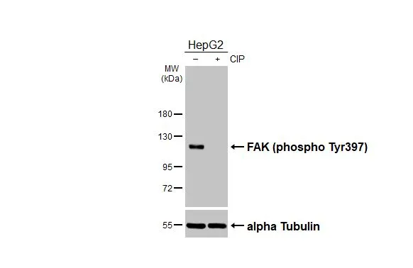 Anti-FAK (phospho Tyr397) antibody (GTX129840) | GeneTex