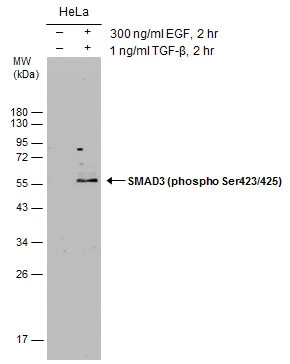 Untreated (–) and treated (+) HeLa whole cell extracts (30 μg) were separated by 12% SDS-PAGE, and the membrane was blotted with SMAD3 (phospho Ser423/425) antibody (GTX129841) diluted at 1:500.